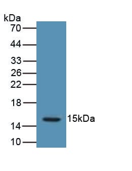 LHB / Luteinizing Hormone Antibody (aa23-141)