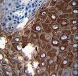 Polyclonal Rabbit anti-Human MMP1 Antibody (aa317-347, IHC, IF, WB)