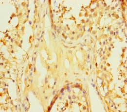 Polyclonal Rabbit anti-Human ZNF252P-AS1 Antibody