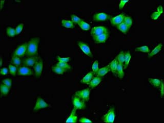 CYP3A4 / Cytochrome P450 3A4 Antibody
