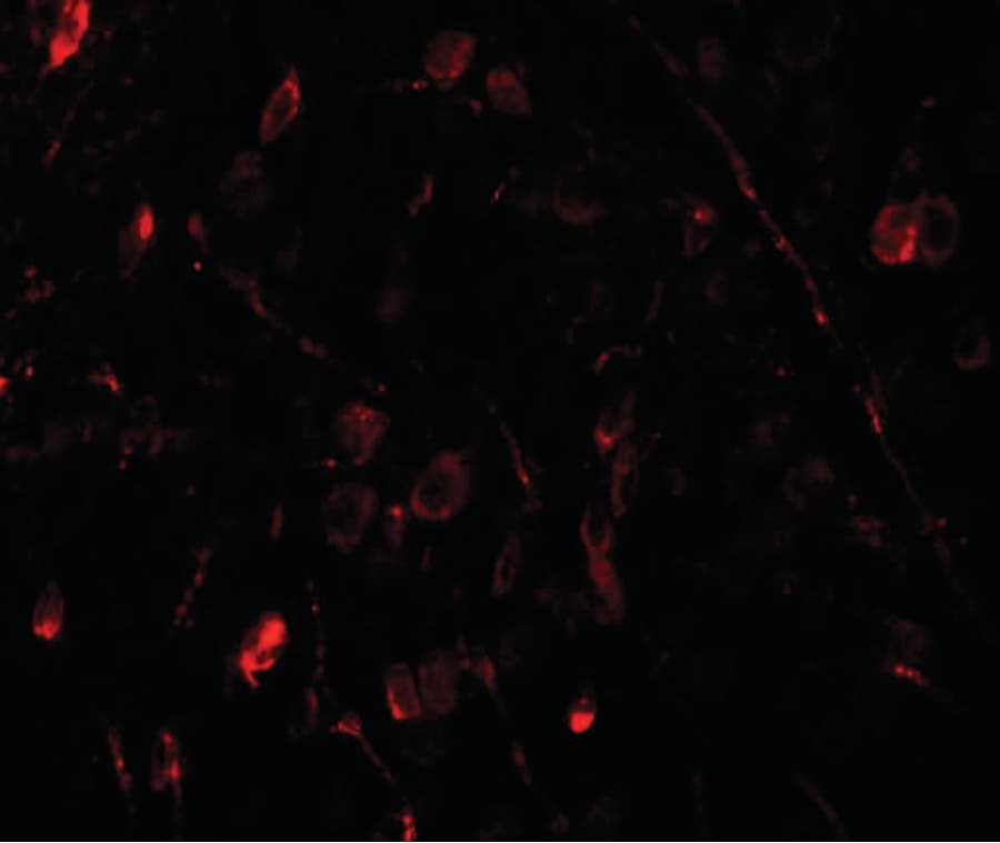 Polyclonal Rabbit anti-Human WIZ Antibody (IHC, IF, WB)