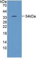 Polyclonal Rabbit anti-Human ANXA5 / Annexin V Antibody (PE, aa1-320, WB)