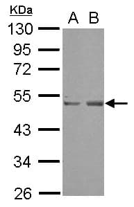 Polyclonal Rabbit anti-Human SETD7 / SET7 Antibody (WB)