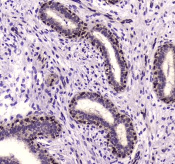 Polyclonal Rabbit anti-Human NFIB Antibody (IHC, WB)