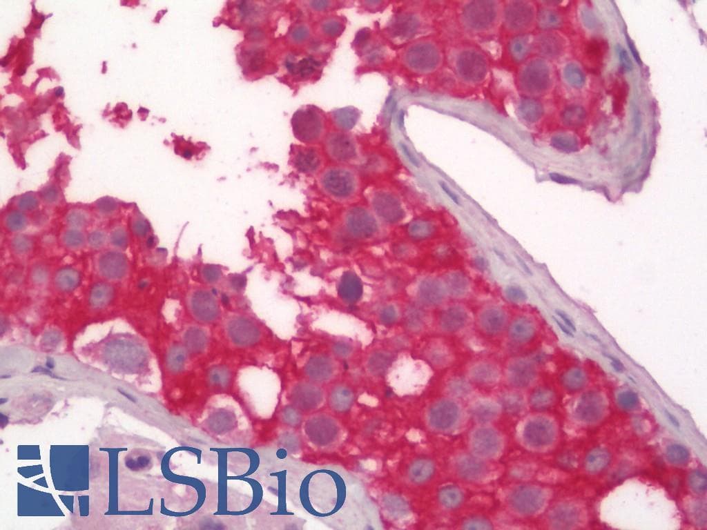 IHC-plus™ VCL / Vinculin Antibody