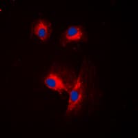 Polyclonal Rabbit anti-Human CDC25A Antibody (N-Terminus, IHC, IF, WB)