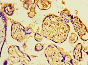CHD1 Antibody (aa1501-1710)