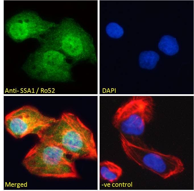 IHC-plus™ Polyclonal Goat anti-Human TRIM21 / RO52 Antibody (aa463-475, IHC, IF, WB)