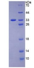 Human KDR / VEGFR2 / FLK1 Protein (Recombinant His)