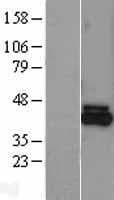 FECH / Ferrochelatase Protein (Over-Expression Lysate Myc-DDK (Flag))