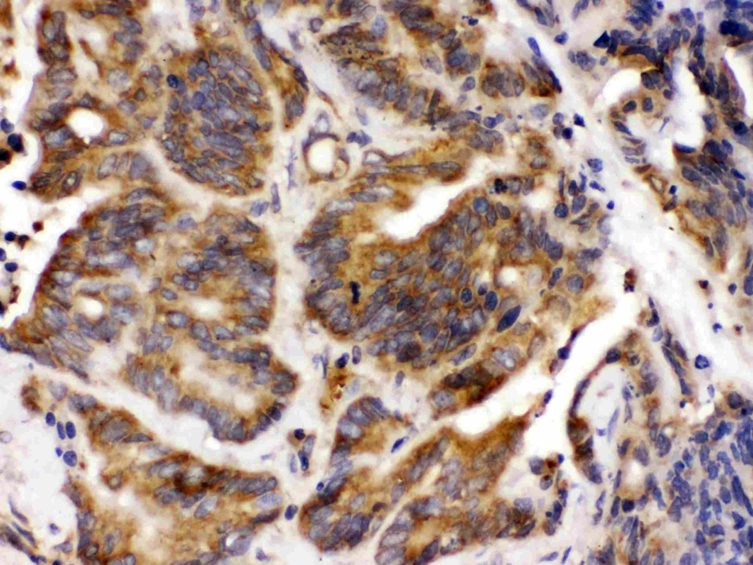 Polyclonal Rabbit anti-Human TLN2 / Talin 2 Antibody (IHC, WB)