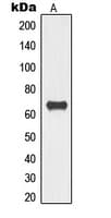 Polyclonal Rabbit anti-Human TOR1AIP1 / LAP1 Antibody (Internal, WB)