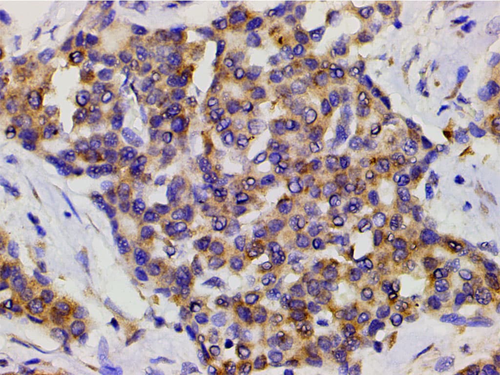 PIK3R1 / p85 Alpha Antibody (phospho-Tyr607)