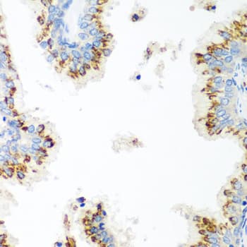 TERE1 / UBIAD1 Antibody