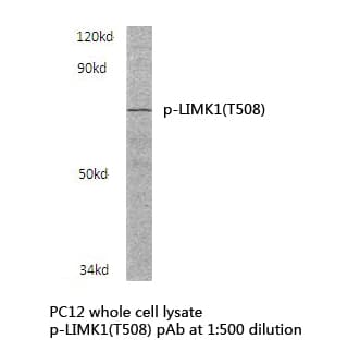 LIMK1 / LIMK Antibody (phospho-Thr508)