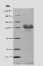 Soy Bean Valosin-Containing Protein (VCP) (Recombinant 6His-SUMO, N-terminus)