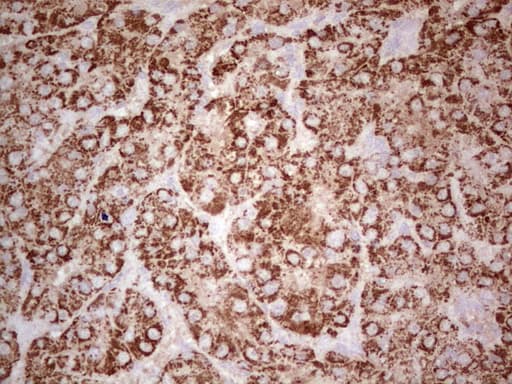 ABAT Antibody (aa29-323, clone OTI7C4)