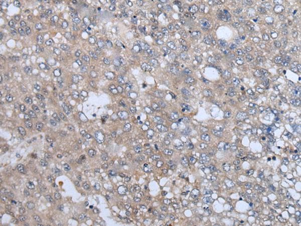 VAMP4 / VAMP-4 Antibody