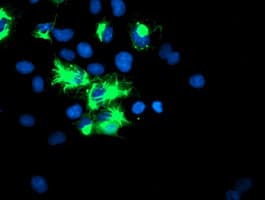 Monoclonal Mouse anti-Human SPRING / TRIM9 Antibody (clone OTI1E4, IF, WB)