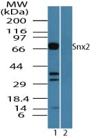 IHC-plus™ Polyclonal Rabbit anti-Human SNX2 Antibody (aa120-170, IHC, WB)