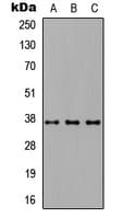 CD66c / CEACAM6 Antibody (Internal)