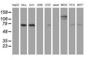 FOLH1 / PSMA Antibody (clone 3H5, Carrier-free)