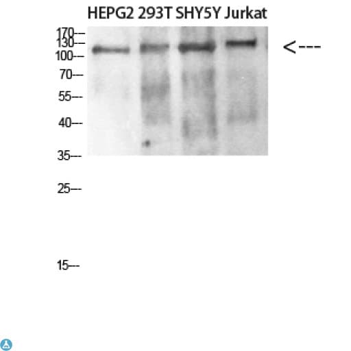 Polyclonal Rabbit anti-Human DAAM1 Antibody (WB)