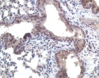 ACKR4 / CCRL1 / CCR11 Antibody (aa4-31)
