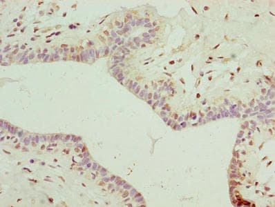 Polyclonal Rabbit anti-Human DDX55 Antibody (IHC)