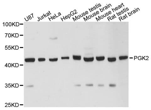 Polyclonal Rabbit anti-Human PGK2 Antibody (WB)