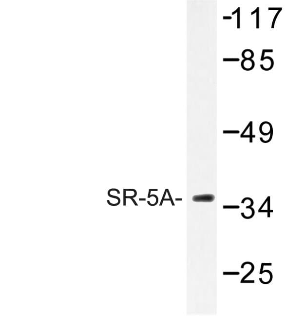 HTR5A / 5-HT5A Receptor Antibody (Leu35)