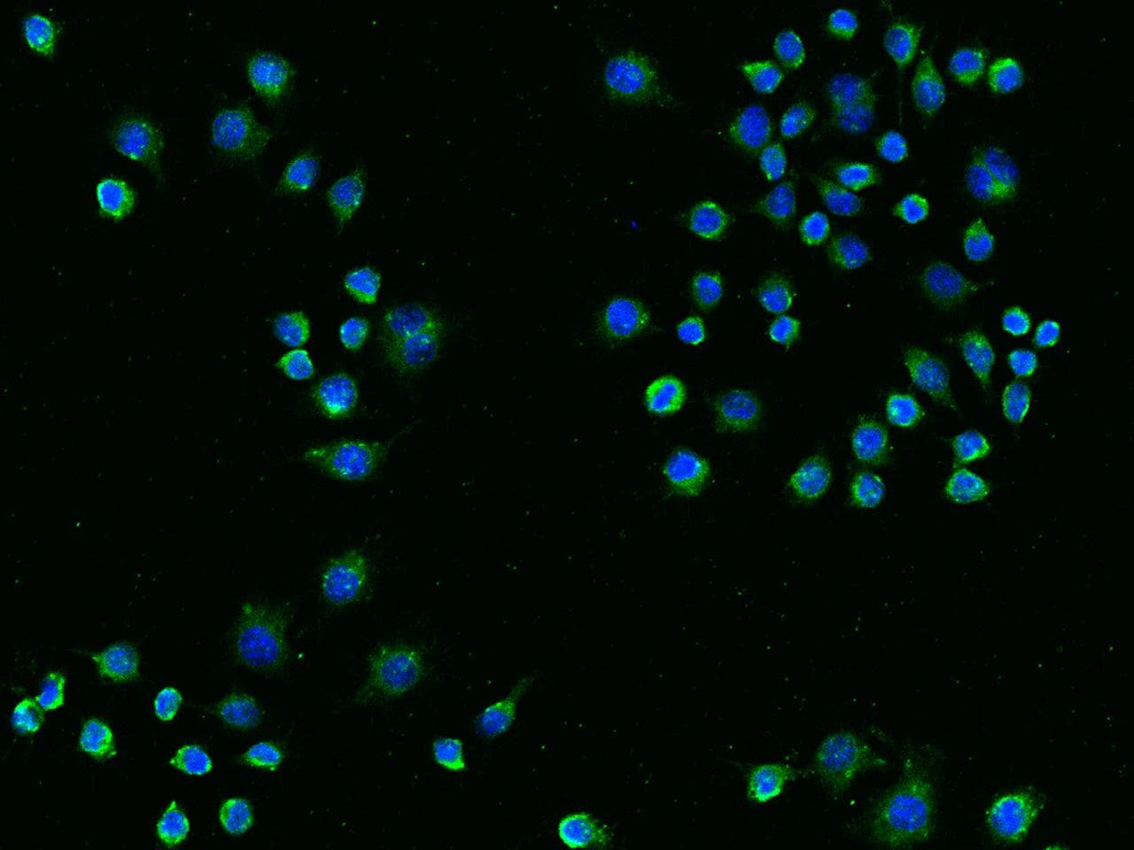 Monoclonal Rabbit anti-Mouse TREM2 / TREM-2 Antibody (clone 014, Preservative Free, aa1-168, IF)
