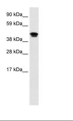 NR1H4 / FXR Antibody (aa194-243)