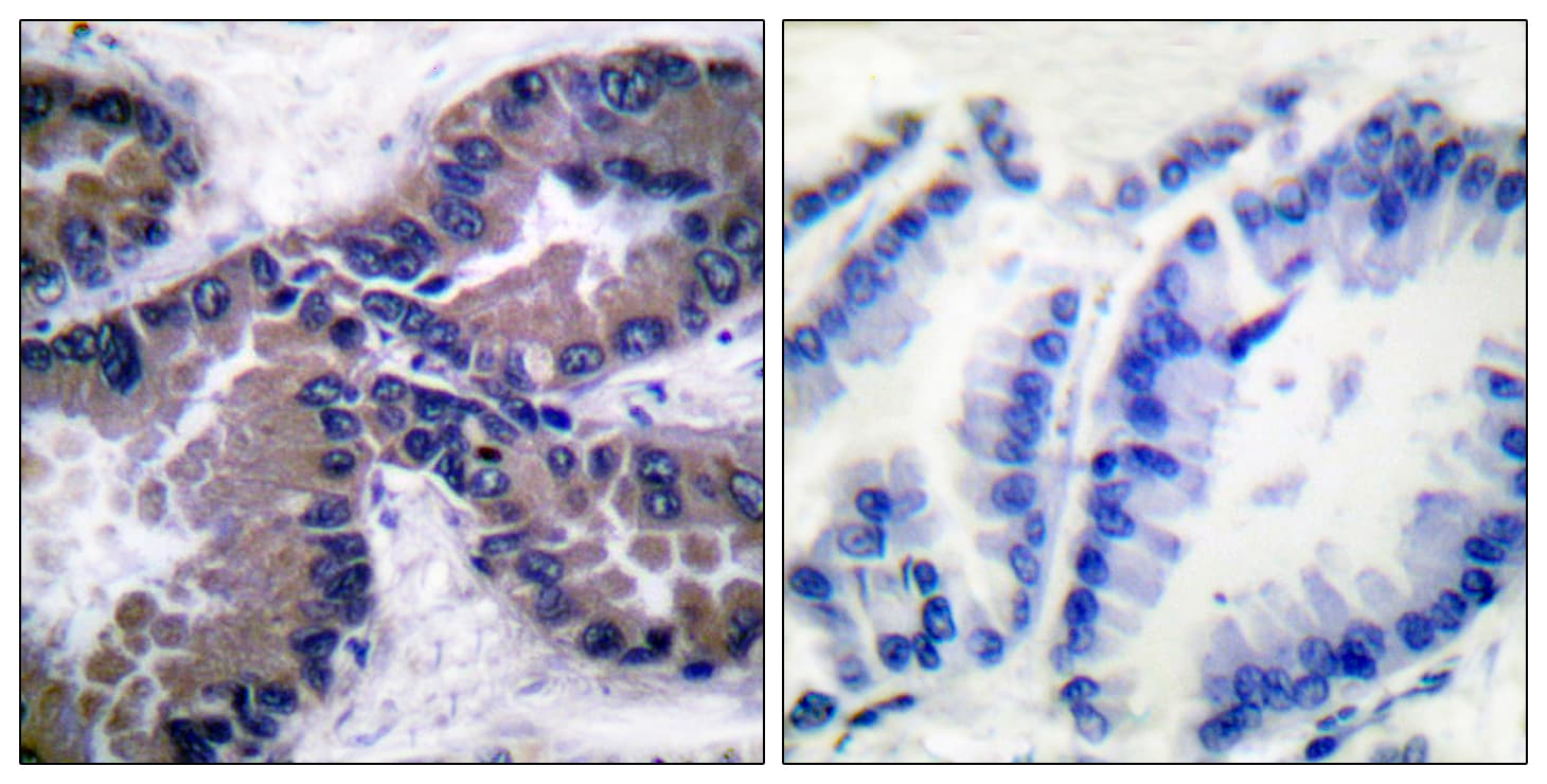 NFE2L2 / NRF2 Antibody (C-Terminus)