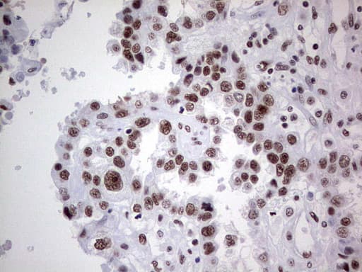 HDAC9 Antibody (aa181-460, clone OTI7G2, Carrier-free)