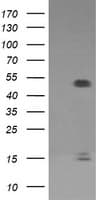FCGR1A / CD64 Antibody (clone OTI1D8)