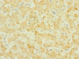 Polyclonal Rabbit anti-Human NOX3 Antibody (IHC, WB)