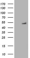 GSS / Glutathione Synthetase Antibody (clone OTI1B8)