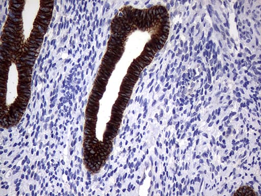 KRT18 / CK18 / Cytokeratin 18 Antibody (aa69-372, clone OTI10H8)