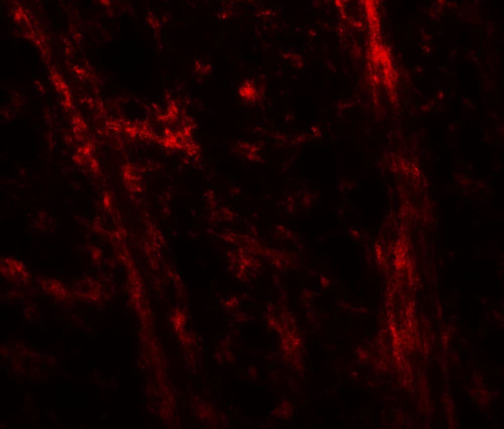 IHC-plus™ Polyclonal Rabbit anti-Human ODZ3 Antibody (IHC, IF, WB)