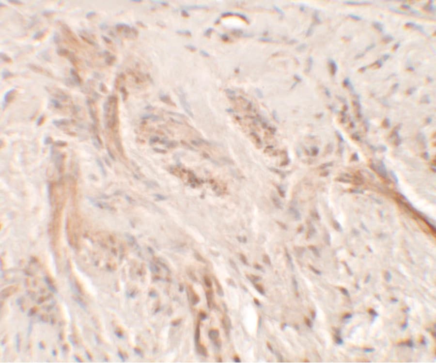 IL1F9 Antibody