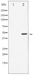 Polyclonal Rabbit anti-Human CCNE1 / Cyclin E1 Antibody (IHC, IF, WB)