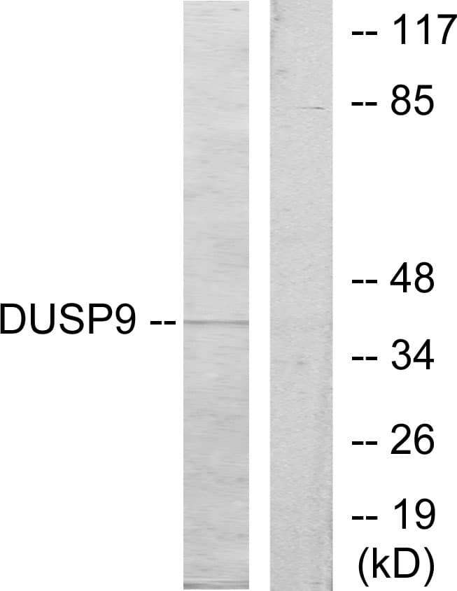 IHC-plus™ Polyclonal Rabbit anti-Human DUSP9 Antibody (aa151-200, IHC, IF, WB)