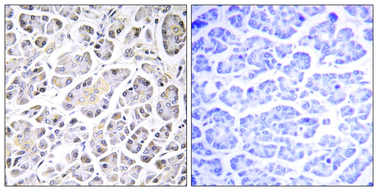 ATP5G3 Antibody