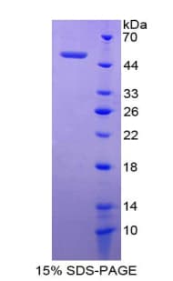 Rat GP9 / CD42a Protein (Recombinant His-GST)