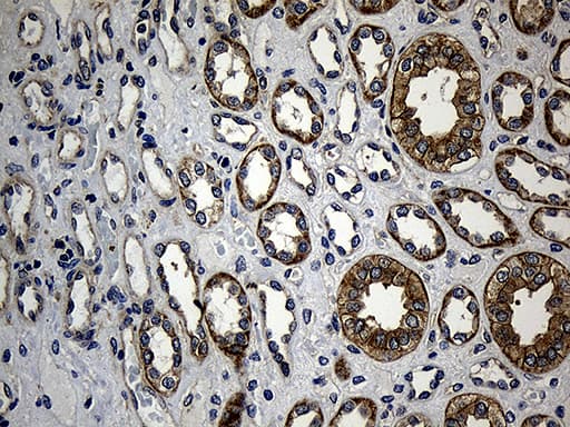 NFKBIE / IKB Epsilon Antibody (clone OTI6H8)
