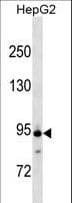 APC4 / ANAPC4 Antibody (aa638-664)