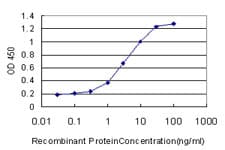 IHC-plus™ Monoclonal Mouse anti-Human ARNT / HIF-1-Beta Antibody (clone 3D10, IHC, IF, WB)