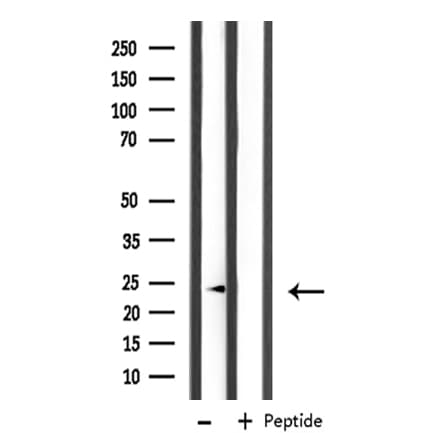MRPL11 Antibody