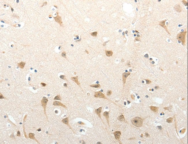 SEMA3D / Semaphorin 3D Antibody